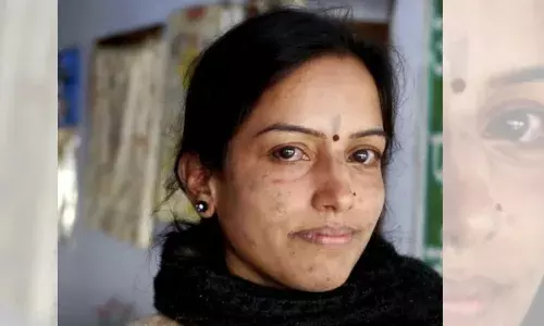 கண்டறியப்படும் நோயாளிகள், இந்தியாவில் மீண்டும் தொழுநோய்?  வல்லுனர்கள் சந்தேகம்;  மாறுபடுகிறது அரசு கண்டறியப்படும் நோயாளிகள், இந்தியாவில் மீண்டும் தொழுநோய்?  வல்லுனர்கள் சந்தேகம்;  மாறுபடுகிறது அரசு